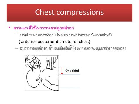 chest compression test trauma|respiratory distress after chest trauma.